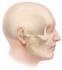 Segmental Defect Facial Nerve – Facial Paralysis Doctor in Texas