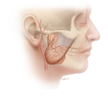 Normal Masseter Nerve Location – Facial Paralysis