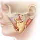 Cross Face Nerve Graft