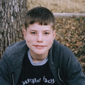 Bell's Palsy & Facial Paralysis Restoration