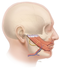Gracilis - Functional Free Muscle Flap for Facial Paralysis